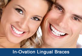 In Ovation Lingual Braces Upper West Side