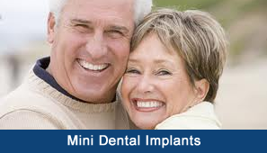 Mini Dental Implants Upper West Side